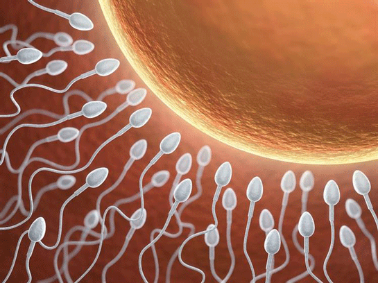 Spermiogram
